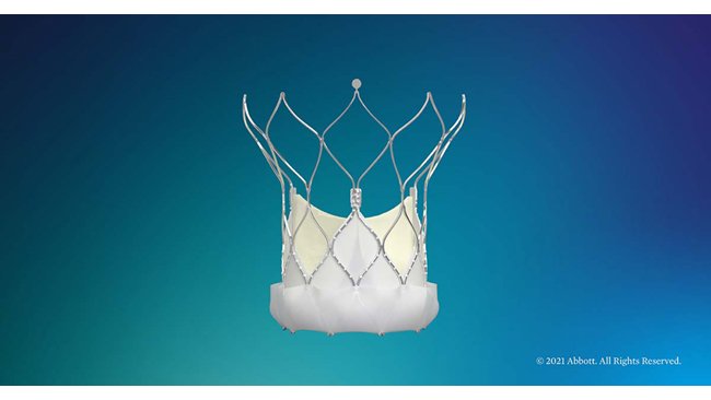 Abbott Launches Navitor™, its Latest-Generation Transcatheter Aortic Valve Implantation (TAVI) System to Treat Aortic Stenosis in India